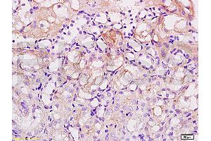 Formalin-fixed and paraffin embedded human kidney tissue labeled with Anti-Acetyl-Histone H1b(K53) Polyclonal Antibody (ABIN729973), Unconjugated at 1:200, followed by conjugation to the secondary antibody and DAB staining (Histone H1 antibody  (acLys52))