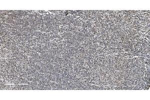 IHC analysis of HP1 alpha/CBX5 using anti-HP1 alpha/CBX5 antibody (ABIN7599057). (CBX5 antibody  (AA 1-191))