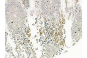 ABIN6259448 and ABIN6275352 at 1/100 staining human normal colon tissue by IHC-P. (PEX2 antibody  (Internal Region))