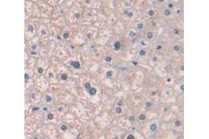IHC-P analysis of Human Tissue, with DAB staining. (ITGA2 antibody  (AA 170-361))