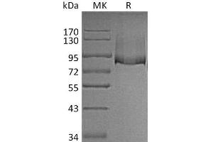 Western Blotting (WB) image for Thrombomodulin (THBD) protein (His tag) (ABIN7320771) (Thrombomodulin Protein (THBD) (His tag))