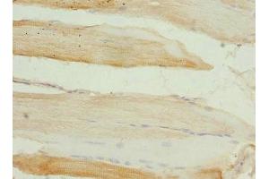 Immunohistochemistry of paraffin-embedded human skeletal muscle tissue using ABIN7149657 at dilution of 1:100