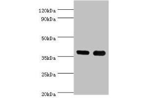 Western blot All lanes: CD1A antibody at 6 μg/mL Lane 1: K562 whole cell lysate Lane 2: Mouse thymus tissue Secondary Goat polyclonal to rabbit IgG at 1/10000 dilution Predicted band size: 37 kDa Observed band size: 37 kDa (CD1a antibody  (AA 21-181))
