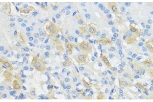 Immunohistochemistry of paraffin-embedded Mouse stomach using GPX2 Polyclonal Antibody at dilution of 1:100 (40x lens). (Glutathione Peroxidase 2 antibody)