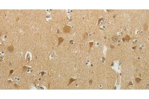 Immunohistochemistry of paraffin-embedded Human brain using MCM4 Polyclonal Antibody at dilution of 1:40 (MCM4 antibody)