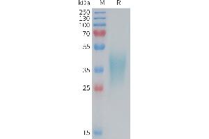 SDS-PAGE (SDS) image for Tumor Necrosis Factor Receptor Superfamily, Member 1B (TNFRSF1B) (AA 23-258) protein (His tag) (ABIN7538581)