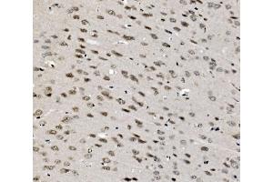 IHC analysis of TAF4 using anti-TAF4 antibody (ABIN7602114).