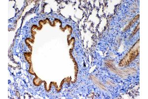 IHC analysis of MMP13 using anti-MMP13 antibody .