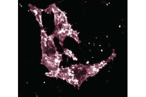 Immunofluorescent staining of HeLa cells. (Ezrin antibody  (AA 391-515))