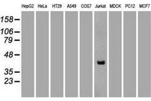 Western blot analysis of extracts (35 µg) from 9 different cell lines by using anti-CD2 monoclonal antibody. (CD2 antibody)