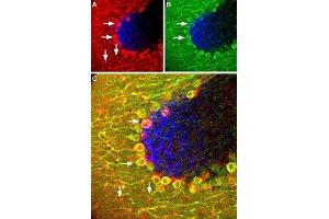 Expression of SSTR5 in mouse cerebellum - Immunohistochemical staining of Somatostatin receptor 5 (SSTR5) in mouse cerebellum using Anti-Somatostatin Receptor Type 5 (extracellular) Antibody (ABIN7043767 and ABIN7045267). (SSTR5 antibody  (Extracellular, N-Term))