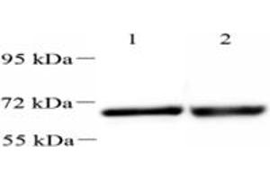 Western blot analysis of UCKL1 (ABIN7076157),at dilution of 1: 2000,Lane 1: HeLa cell lysate,Lane 2: Mouse kidney tissue lysate (UCKL1 antibody)