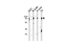 Western blot analysis in U251,rat C6 cell line,mouse brain,rat brain tissue lysates (35ug/lane). (FUBP1 antibody  (AA 240-268))