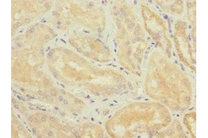 Immunohistochemistry of paraffin-embedded human kidney tissue using ABIN7173811 at dilution of 1:100 (TNFSF15 antibody  (AA 72-251))