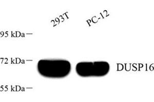 Western blot analysis of DUSP16 (ABIN7073775) at dilution of 1: 1000 (DUSP16 antibody)