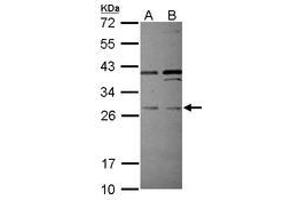 Image no. 2 for anti-Pleckstrin Homology Domain Containing, Family F (With FYVE Domain) Member 2 (PLEKHF2) (AA 60-249) antibody (ABIN1500276) (PLEKHF2 antibody  (AA 60-249))