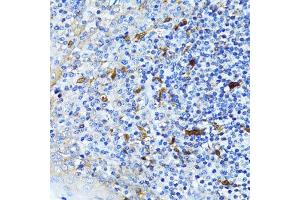 Immunohistochemistry of paraffin-embedded human tonsil using CTNNB1 antibody. (CTNNB1 antibody  (AA 1-100))
