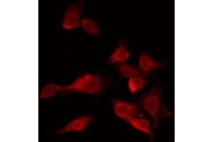 ABIN6276073 staining LOVO by IF/ICC. (OR13C3 antibody  (N-Term))