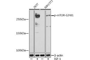 Western blot analysis of extracts of various cell lines, using Phospho-mTOR-S2481 (ABIN7268436) at 1:1000 dilution. (MTOR antibody  (pSer2481))