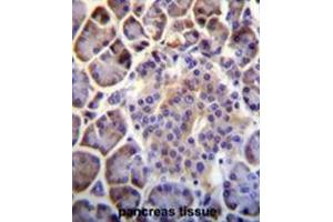 C6orf138 Antibody (Center) immunohistochemistry analysis in formalin fixed and paraffin embedded human pancreas tissue followed by peroxidase conjugation of the secondary antibody and DAB staining. (PTCHD4 antibody  (Middle Region))