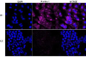 Immunocytochemical staining of HeLa cells using Flotillin 1 antibody (ABIN7798632), 1:1,000), Top panel: wild-type (WT), Bottom panal: Flotillin 1 shRNA knockdown (KD).