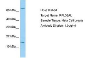 Image no. 1 for anti-Ribosomal Protein L36a-Like (RPL36AL) (C-Term) antibody (ABIN6749891) (RPL36AL antibody  (C-Term))