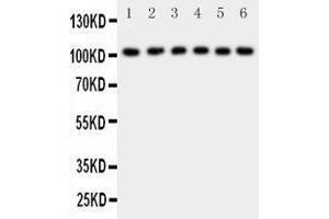 Western Blotting (WB) image for anti-Nuclear Factor of kappa Light Polypeptide Gene Enhancer in B-Cells 1 (NFKB1) (AA 778-797), (C-Term) antibody (ABIN3042654) (NFKB1 antibody  (C-Term))