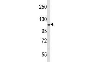 Western blot analysis of PERK antibody and 293 lysate (PERK antibody  (AA 148-175))