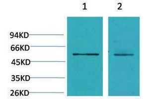 Western Blotting (WB) image for anti-Calcium Channel, Voltage-Dependent, beta 3 Subunit (CACNB3) antibody (ABIN3188037)