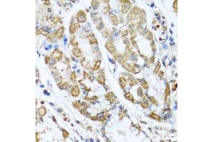 Immunohistochemistry of paraffin-embedded human stomach using ANTXR2 antibody. (ANTXR2 antibody  (AA 339-488))