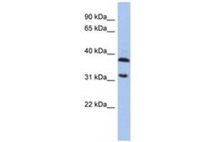 Image no. 1 for anti-Aspartoacylase (ASPA) (AA 143-192) antibody (ABIN6743963) (ASPA antibody  (AA 143-192))