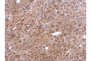 Immunohistochemistry (IHC) image for anti-TNFAIP3 Interacting Protein 2 (TNIP2) (Center) antibody (ABIN2854507)