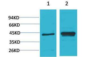 Western Blotting (WB) image for anti-Nuclear Factor of kappa Light Polypeptide Gene Enhancer in B-Cells Inhibitor, alpha (NFKBIA) antibody (ABIN3188043) (NFKBIA antibody)