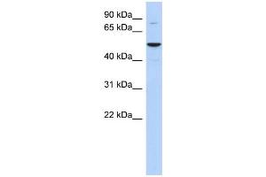 WB Suggested Anti-HTATIP Antibody Titration: 0. (KAT5 antibody  (Middle Region))