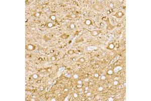 Immunohistochemistry of paraffin-embedded mouse brain using NgR3 Rabbit mAb (ABIN7269932) at dilution of 1:50 (40x lens). (RTN4RL1 antibody)