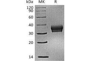 Western Blotting (WB) image for Sialic Acid Binding Ig-Like Lectin 15 (SIGLEC15) (Active) protein (His tag) (ABIN7320882) (SIGLEC15 Protein (His tag))