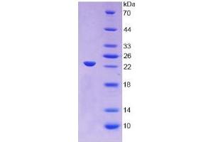 SDS-PAGE (SDS) image for Orosomucoid 1 (ORM1) ELISA Kit (ABIN6574212)