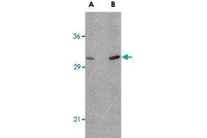 Western blot analysis of ATG12 in human brain tissue lysate with ATG12 polyclonal antibody  at (A) 0.