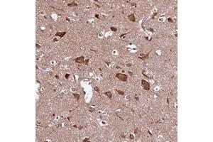 Immunohistochemical staining of human cerebral cortex with HYLS1 polyclonal antibody  shows strong cytoplasmic positivity in neuronal cells.