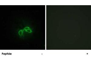 Immunofluorescence analysis of NIH/3T3 cells, using BLCAP polyclonal antibody .