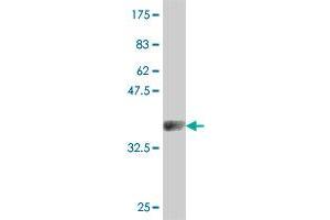 Western Blot detection against Immunogen (36. (CACNA1S antibody  (AA 1743-1838))