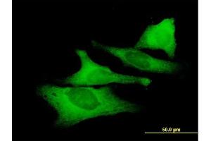 Immunofluorescence of purified MaxPab antibody to UNC45A on HeLa cell. (UNC45A antibody  (AA 1-944))