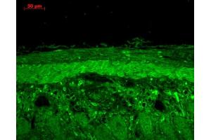 Immunohistochemistry analysis using Rabbit Anti-HSP22 Polyclonal Antibody (ABIN361851 and ABIN361852).