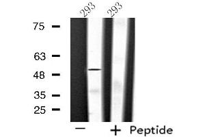 Western blot analysis of extracts from 293 cells using SLC39A7 antibody. (SLC39A7 antibody  (Internal Region))