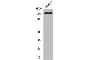 Western Blot analysis of HeLa cells using EphB6 Polyclonal Antibody (EPH Receptor B6 antibody  (C-Term))