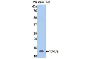 Western Blotting (WB) image for anti-Vitamin D-Binding Protein (GC) (AA 395-475) antibody (ABIN1078668) (Vitamin D-Binding Protein antibody  (AA 395-475))