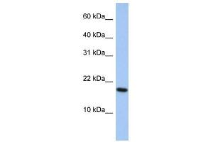 WB Suggested Anti-ARL5A Antibody Titration: 0. (ARL5A antibody  (Middle Region))