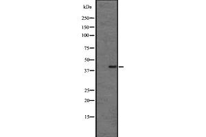 Western blot analysis of CMKLR1 expression in HL60 cell lysate ;,The lane on the left is treated with the antigen-specific peptide. (CMKLR1 antibody  (Internal Region))