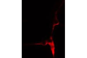 ABIN6269003 staining HeLa cells by IF/ICC. (COL3A1 antibody  (N-Term))