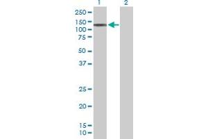 Western Blot analysis of STK36 expression in transfected 293T cell line by STK36 MaxPab polyclonal antibody. (STK36 antibody  (AA 1-1315))